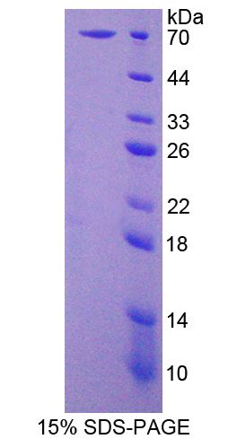 无翅型MMTV整合位点家族成员16(WNT16)重组蛋白,Recombinant Wingless Type MMTV Integration Site Family, Member 16 (WNT16)