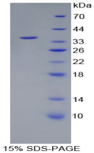 无翅型MMTV整合位点家族成员10B(WNT10B)重组蛋白,Recombinant Wingless Type MMTV Integration Site Family, Member 10B (WNT10B)