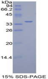 无补缀同源物1(DISP1)重组蛋白,Recombinant Dispatched Homolog 1 (DISP1)