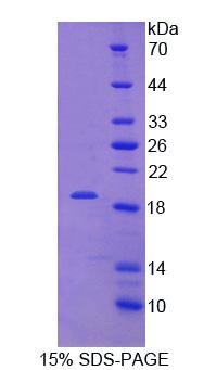 吻素1(KISS1)重组蛋白,Recombinant Kisspeptin 1 (KISS1)