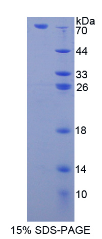 胃脂酶(LIPF)重组蛋白,Recombinant Lipase, Gastric (LIPF)