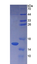 胃泌素释放肽前体(ProGRP)重组蛋白,Recombinant Pro-Gastrin Releasing Peptide (ProGRP)