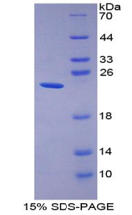 胃动蛋白2(GKN2)重组蛋白,Recombinant Gastrokine 2 (GKN2)