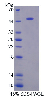 胃动蛋白1(GKN1)重组蛋白,Recombinant Gastrokine 1 (GKN1)