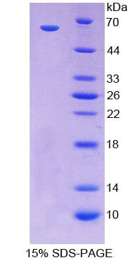 尾型同源框转录因子2(CDX2)重组蛋白,Recombinant Caudal Type Homeobox 2 (CDX2)