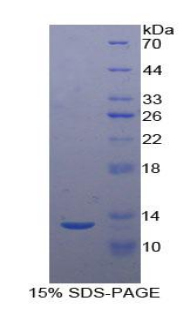 尾加壓素2(UST2)重組蛋白,Recombinant Urotensin 2 (UST2)