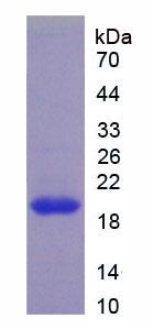 维生素D受体(VDR)重组蛋白,Recombinant Vitamin D Receptor (VDR)