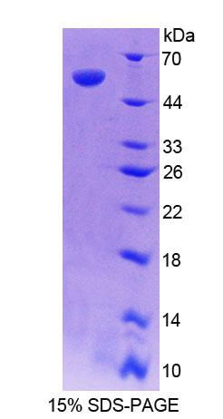 维甲酸受体应答基因1(RARRES1)重组蛋白,Recombinant Retinoic Acid Receptor Responder 1 (RARRES1)