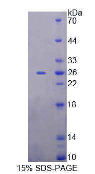 微小染色体维持缺陷蛋白5(MCM5)重组蛋白,Recombinant Minichromosome Maintenance Deficient 5 (MCM5)