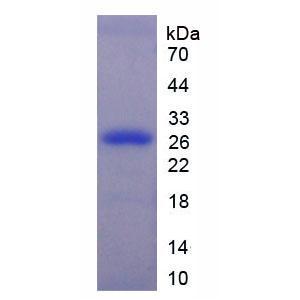 细胞外信号调节激酶1(ERK1)重组蛋白
