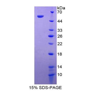 细胞死亡诱导DFFA样效应蛋白A(CIDEA)重组蛋白
