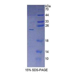细胞色素P450家族成员5A1(CYP5A1)重组蛋白,Recombinant Cytochrome P450 5A1 (CYP5A1)