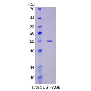 细胞色素P450家族成员3A4(CYP3A4)重组蛋白