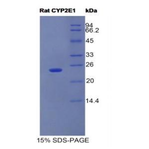 细胞色素P450家族成员2E1(CYP2E1)重组蛋白