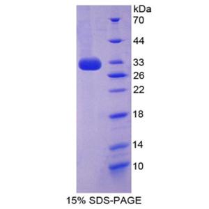 细胞色素P450家族成员27B1(CYP27B1)重组蛋白,Recombinant Cytochrome P450 27B1 (CYP27B1)