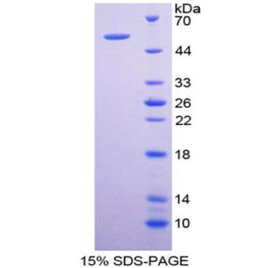 细胞色素P450家族成员26B1(CYP26B1)重组蛋白,Recombinant Cytochrome P450 26B1 (CYP26B1)