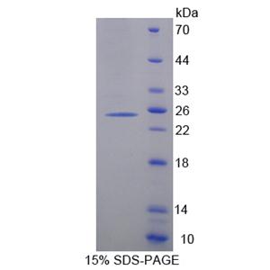 細(xì)胞色素P450家族成員26A1(CYP26A1)重組蛋白,Recombinant Cytochrome P450 26A1 (CYP26A1)