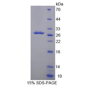细胞色素P450家族成员24A1(CYP24A1)重组蛋白
