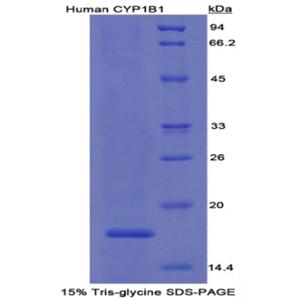 细胞色素P450家族成员1B1(CYP1B1)重组蛋白
