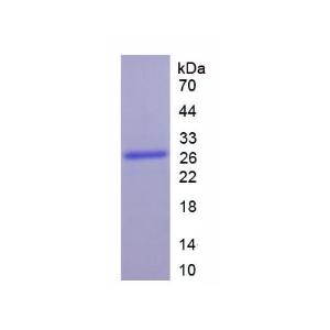 细胞色素P450家族成员1A1(CYP1A1)重组蛋白