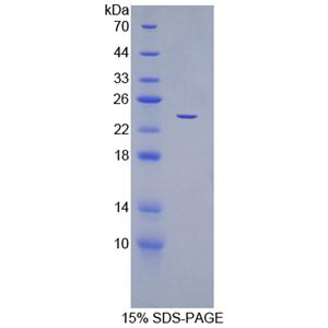 细胞分裂周期因子25B(CDC25B)重组蛋白