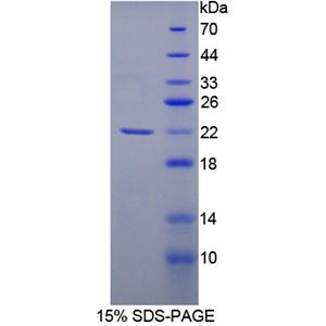 细胞分裂周期因子25(CDC25)重组蛋白
