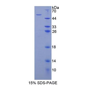 细胞程序性死亡蛋白6相互作用蛋白(PDCD6IP)重组蛋白,Recombinant Programmed Cell Death Protein 6 Interacting Protein (PDCD6IP)