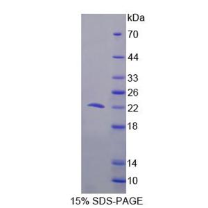 细胞程序性死亡蛋白6(PDCD6)重组蛋白,Recombinant Programmed Cell Death Protein 6 (PDCD6)