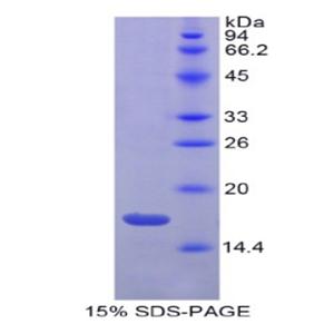 胃动蛋白3(GKN3)重组蛋白