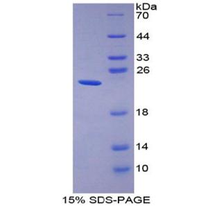 胃动蛋白2(GKN2)重组蛋白,Recombinant Gastrokine 2 (GKN2)