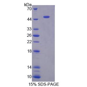 胃动蛋白1(GKN1)重组蛋白,Recombinant Gastrokine 1 (GKN1)