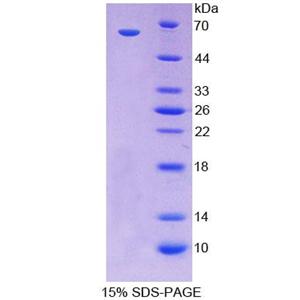 尾型同源框转录因子2(CDX2)重组蛋白