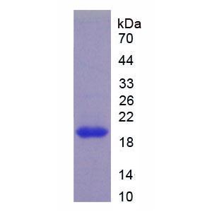 维生素D受体(VDR)重组蛋白,Recombinant Vitamin D Receptor (VDR)