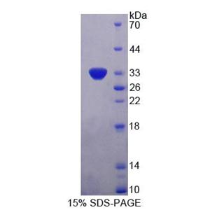 围脂滴蛋白4(PLIN4)重组蛋白