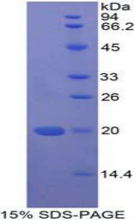 微纤丝关联蛋白5(MFAP5)重组蛋白,Recombinant Microfibrillar Associated Protein 5 (MFAP5)