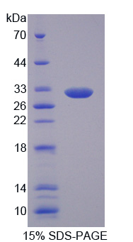 微纤丝关联蛋白4(MFAP4)重组蛋白,Recombinant Microfibrillar Associated Protein 4 (MFAP4)