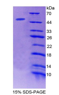 微纤丝关联蛋白2(MFAP2)重组蛋白,Recombinant Microfibrillar Associated Protein 2 (MFAP2)