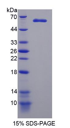 微管关联丝/苏氨酸激酶2(MAST2)重组蛋白,Recombinant Microtubule Associated Serine/Threonine Kinase 2 (MAST2)