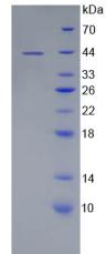 微管关联蛋白2(MAP2)重组蛋白,Recombinant Microtubule Associated Protein 2 (MAP2)