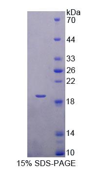 微管蛋白折叠辅酶A(TBCA)重组蛋白,Recombinant Tubulin Folding Cofactor A (TBCA)