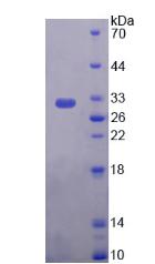 网蛋白(PLEC)重组蛋白,Recombinant Plectin (PLEC)