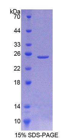 唾液酸酶2(SIAL2)重組蛋白,Recombinant Sialidase 2, Cytosolic (SIAL2)