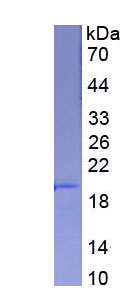 唾液酸结合Ig样凝集素5(SIGLEC5)重组蛋白,Recombinant Sialic Acid Binding Ig Like Lectin 5 (SIGLEC5)