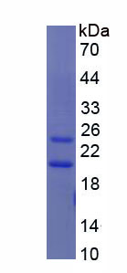 唾液酸结合Ig样凝集素12(SIGLEC12)重组蛋白,Recombinant Sialic Acid Binding Ig Like Lectin 12 (SIGLEC12)