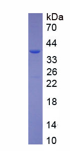 唾液富组蛋白3(HTN3)重组蛋白,Recombinant Histatin 3 (HTN3)