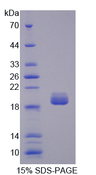 拓扑异构酶Ⅲ(TOP3)重组蛋白,Recombinant Topoisomerase III (TOP3)