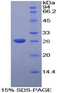 脫氧核糖核酸酶Ⅰ樣2(DNASE1L2)重組蛋白,Recombinant Deoxyribonuclease I Like Protein 2 (DNASE1L2)