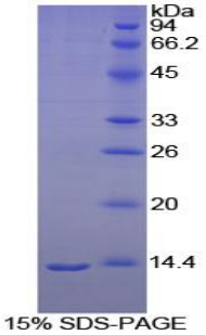 褪黑素受體1A(MTNR1A)重組蛋白,Recombinant Melatonin Receptor 1A (MTNR1A)