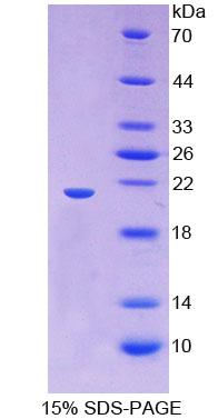 透明质酸介导运动因子受体(HMMR)重组蛋白,Recombinant Hyaluronan Mediated Motility Receptor (HMMR)