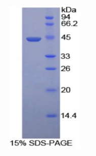 透明质酸氨基葡糖苷酶2(HYAL2)重组蛋白,Recombinant Hyaluronoglucosaminidase 2 (HYAL2)